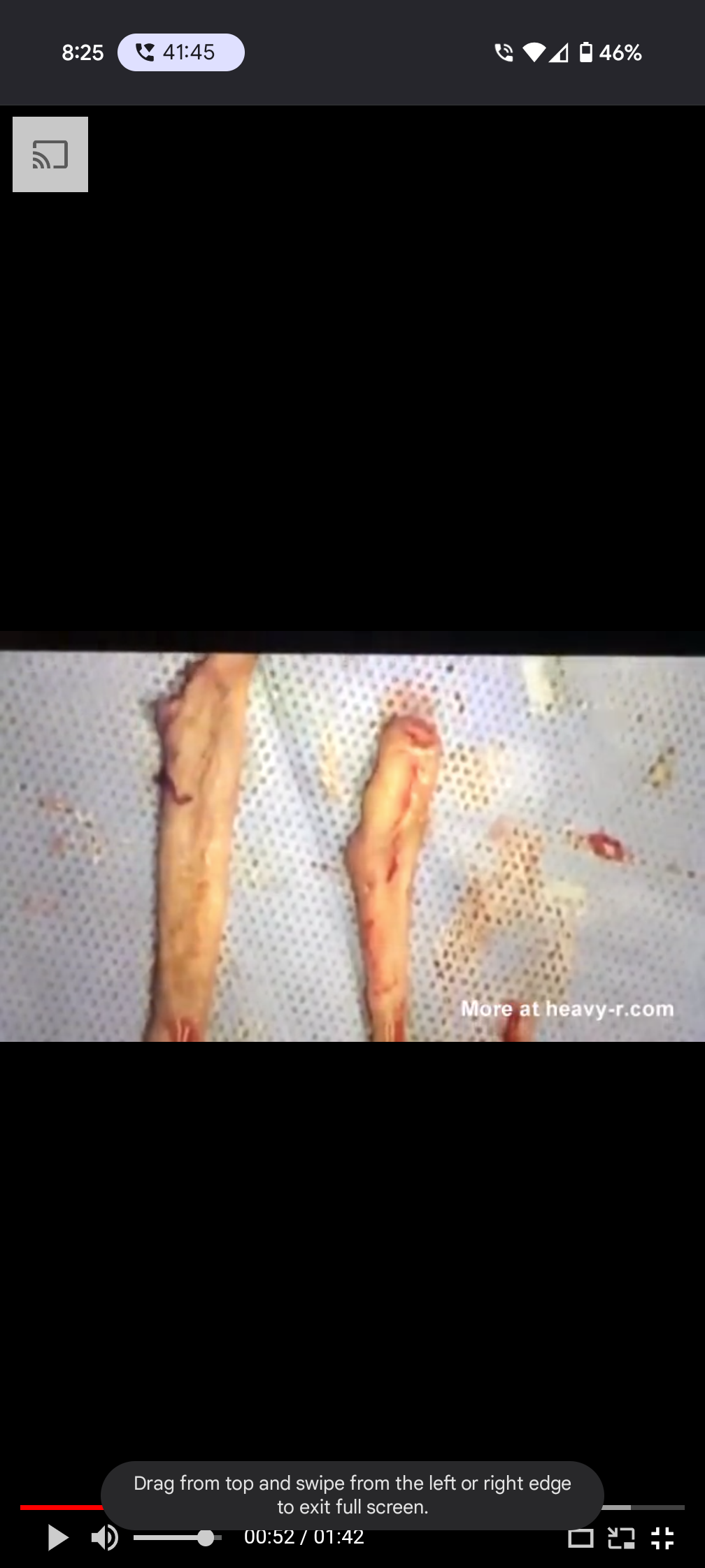 Vaginal mutilation — 12